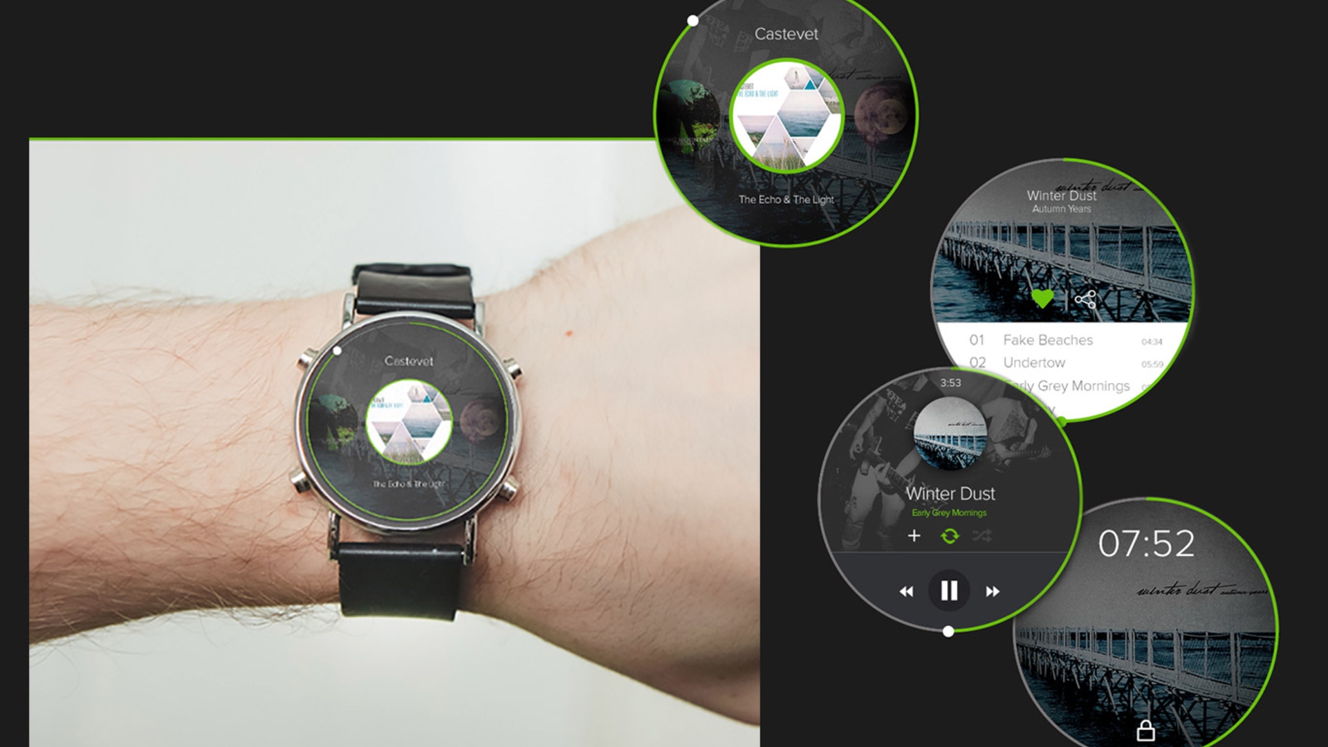 Das iWatch-Konzept mit Spotify zeigt vier physische Buttons inklusive Touchscreen