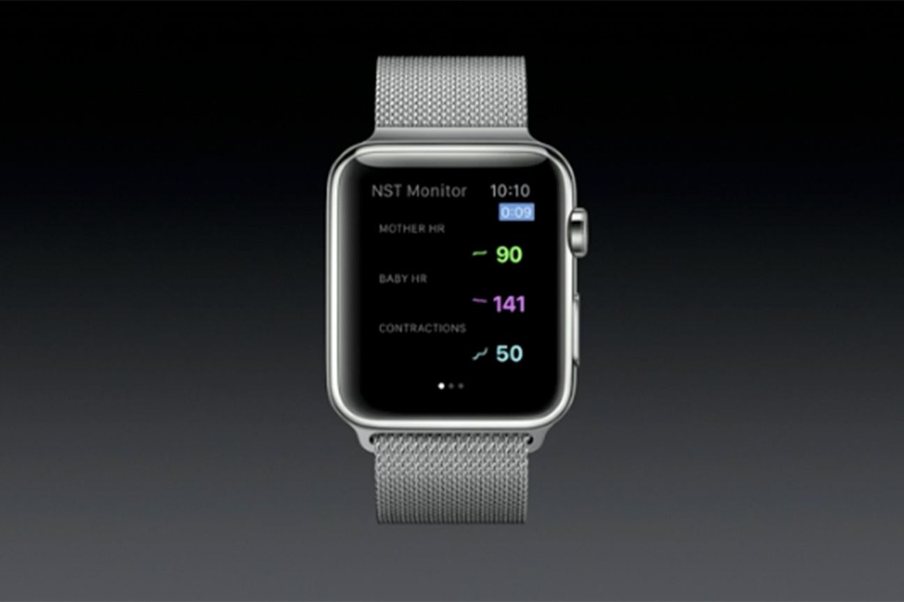 Apple Watch